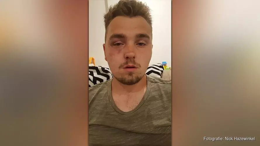 Nick (21) door groep jongens mishandeld na avondje uit